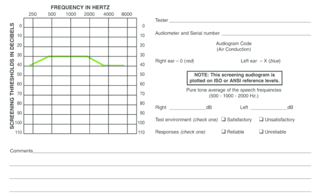 Blank Audiogram - Fill Online, Printable, Fillable, Blank in Blank Audiogram Template Download