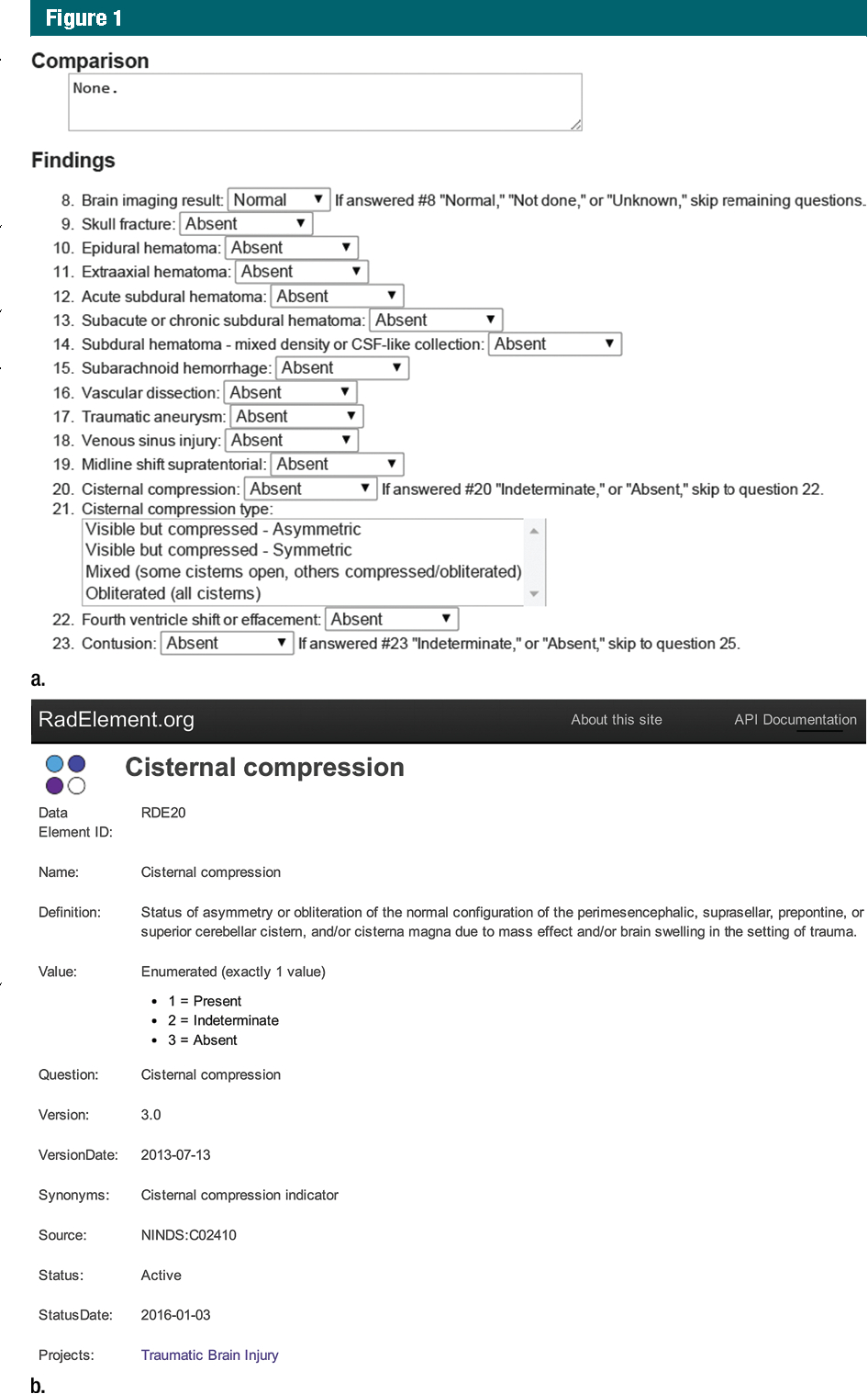 Report Examples Large Ogy Template Case Example Format For Chiropractic X Ray Report Template